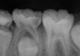 xray