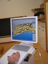 cerec 1