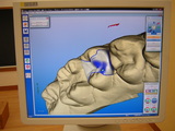 cerec4
