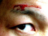 20120320_blood_01