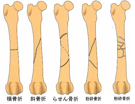 20110814201500c94