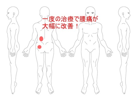 一度の治療で腰痛が大幅に改善