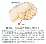 Eichhoff(アイヒホッフ)テスト