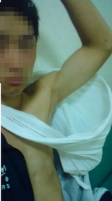 上肢の挙上が可能