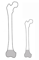 骨端からの長さが決まっている場合
