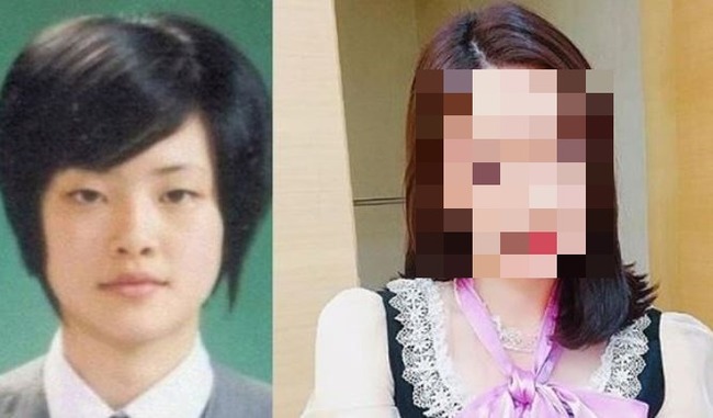 女優のホン・スア整形を告白