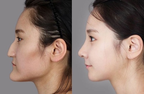 korean_plastic_surgery_21