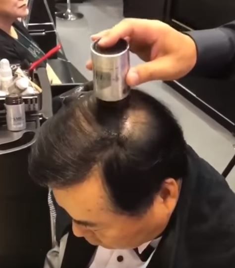 ハゲ隠し