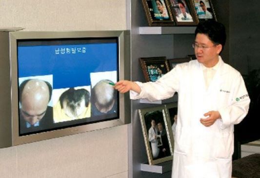 韓国人男性の半数が脱毛症に苦しむ