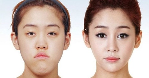 korean_plastic_surgery_05