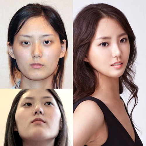 korean_plastic_surgery_30