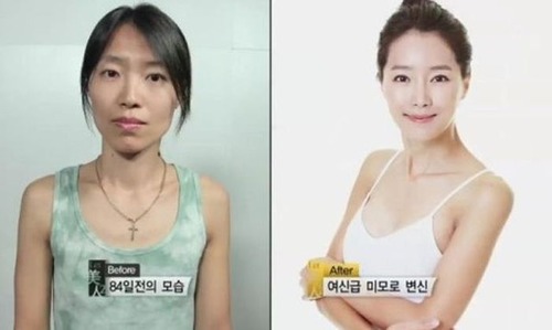 korean_plastic_surgery_26