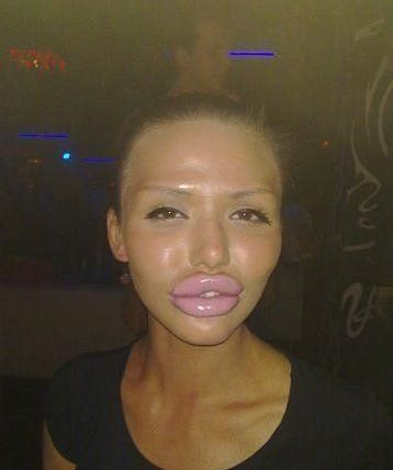 annoying-girls-with-huge-lips02