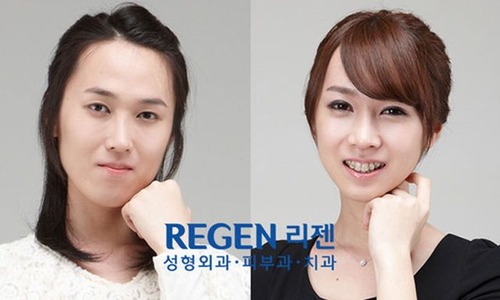 korean_plastic_surgery_41