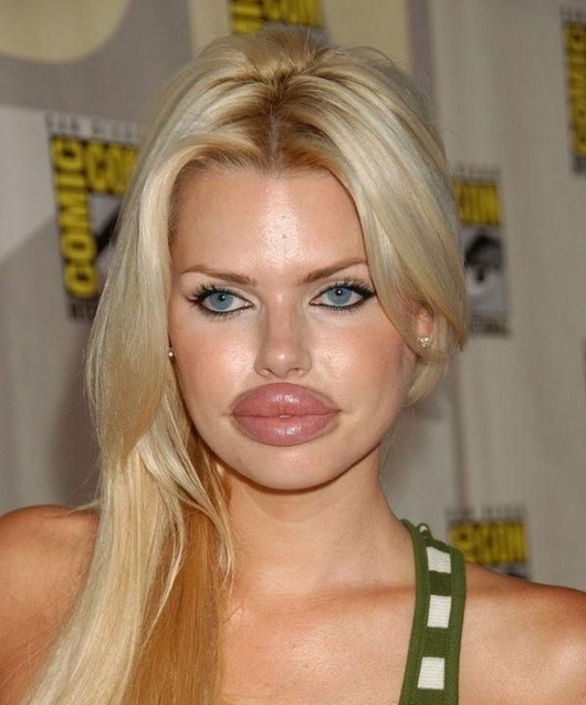 annoying-girls-with-huge-lips12