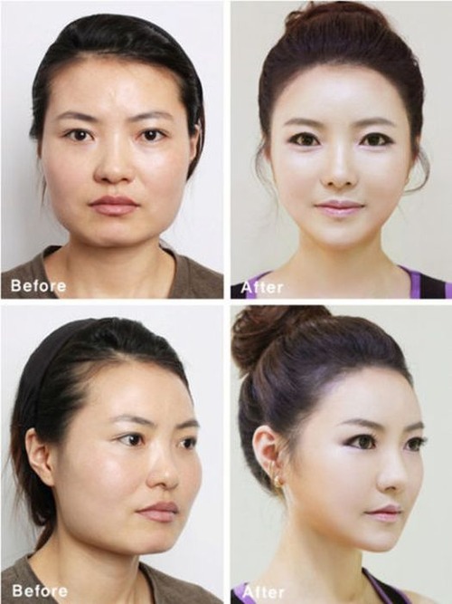 korean_plastic_surgery_39