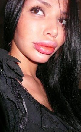 annoying-girls-with-huge-lips01