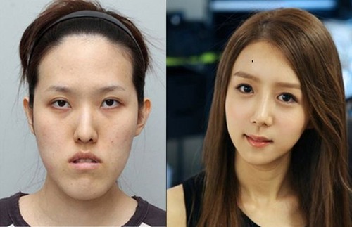 korean_plastic_surgery_07