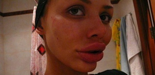 annoying-girls-with-huge-lips04