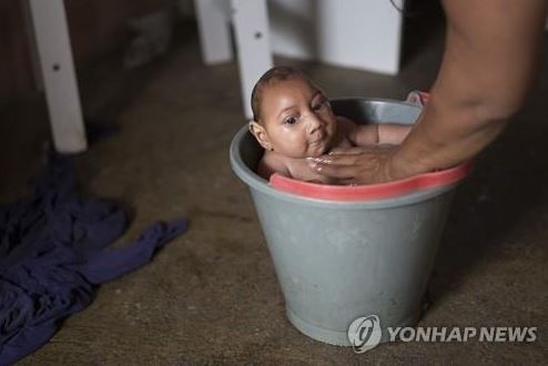 小頭症