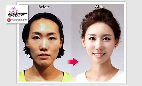 korean_plastic_surgery_14
