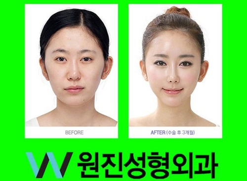 korean_plastic_surgery_15