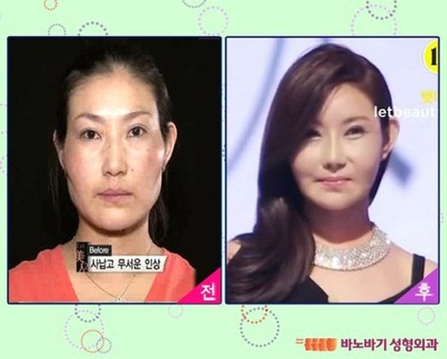 korean_plastic_surgery_03