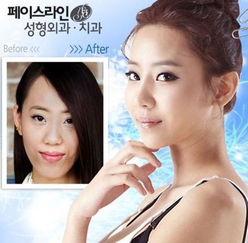 korean_plastic_surgery_32