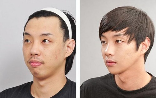 korean_plastic_surgery_02
