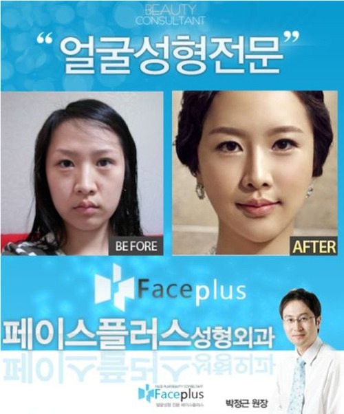 korean_plastic_surgery_22