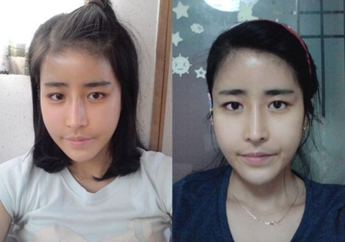 korean_plastic_surgery_08