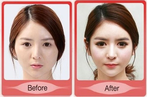 korean_plastic_surgery_04