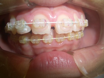 CIMG0775