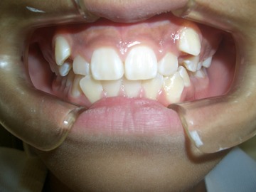 CIMG0744