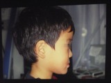 子供の歯並び・歯列育形成・床矯正・小児矯正・反対咬合