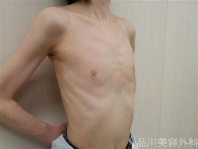 125