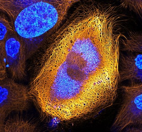 nikon-small-world-photomicrography-competition-2017-winners-27