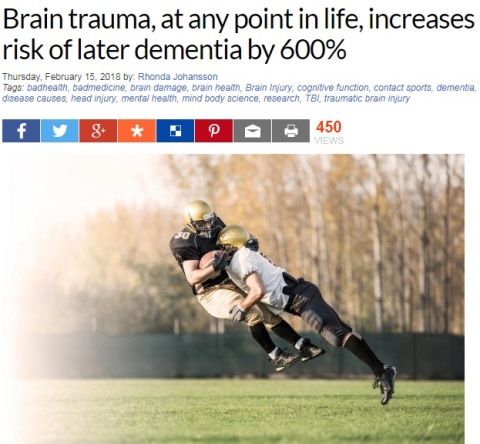 brain