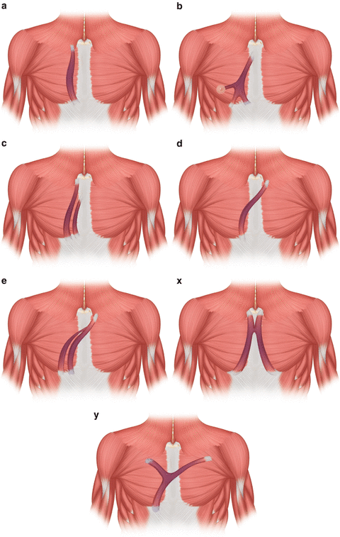 306495_1_En_4_Fig1_HTML