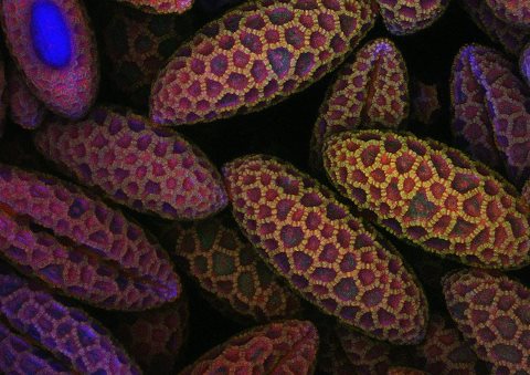 nikon-small-world-photomicrography-competition-2017-winners-25-1