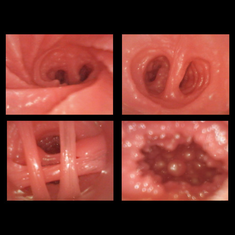 PT06