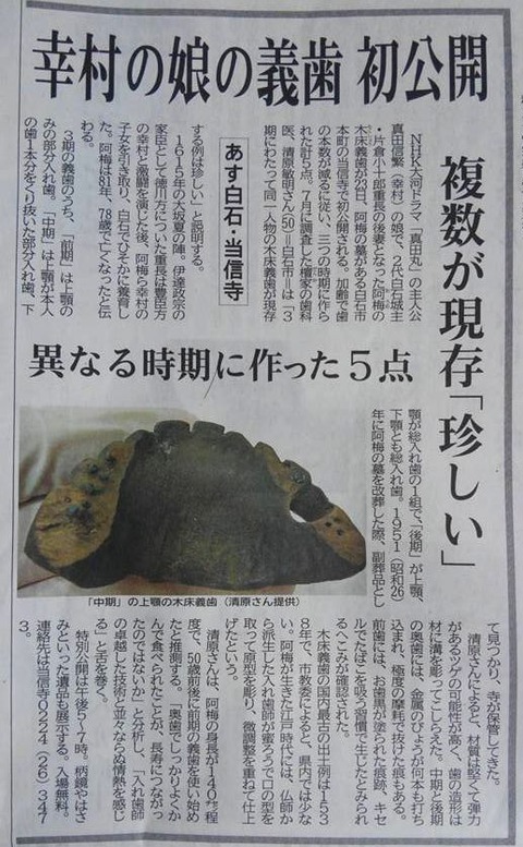 阿梅姫の義歯
