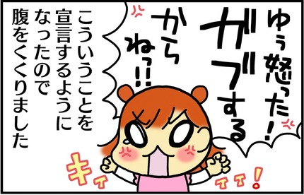 20170116-3