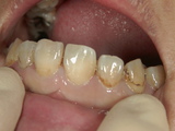 PICT0006