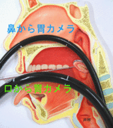 鼻から胃カメラ