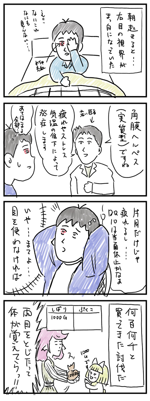 4コマ角膜ヘルペス（実質型）