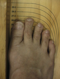 d-fitting board2