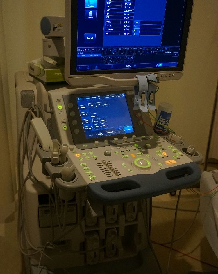 超音波心臓検査機