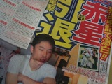 CA9INJM3