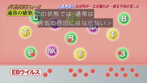 慢性活動性EBウイルス感染症 CAEBV